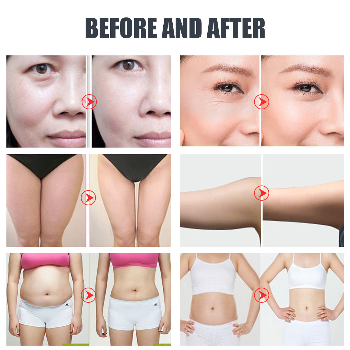 Máy cavitation 40K SQ47B Pro 6 trong 1 với RF đa cực, chân không, EMS & laser