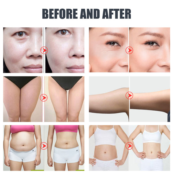 Máy cavitation 40K SQ47B Pro 6 trong 1 với RF đa cực, chân không, EMS & laser