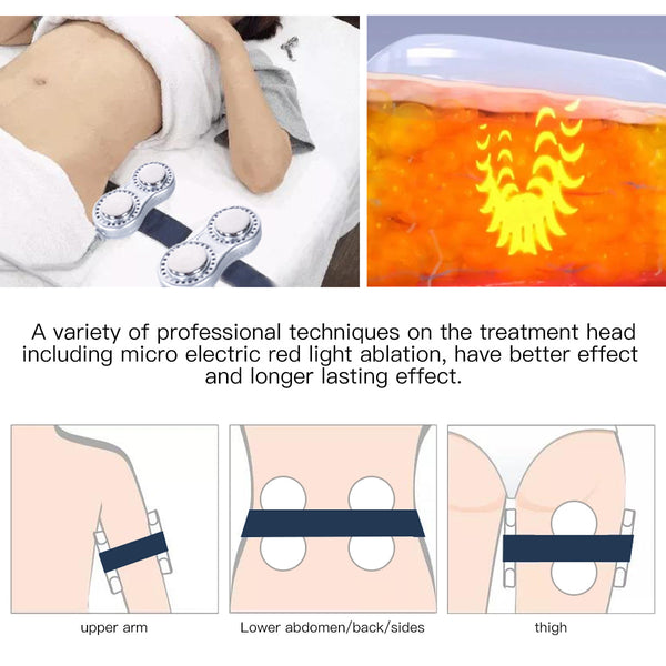 Máy cavitation 40K SQ47B Pro 6 trong 1 với RF đa cực, chân không, EMS & laser