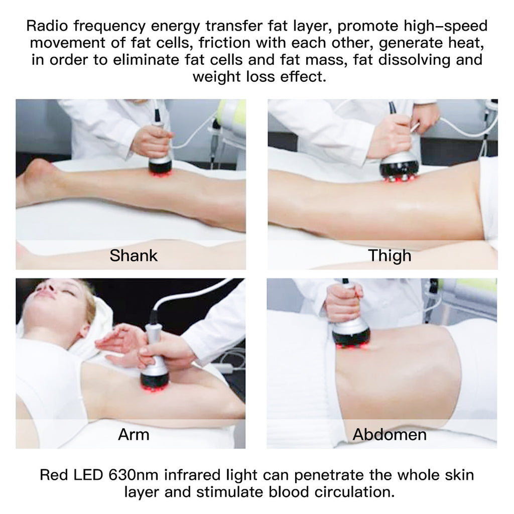 Máy cavitation 40K SQ47B Pro 6 trong 1 với RF đa cực, chân không, EMS & laser