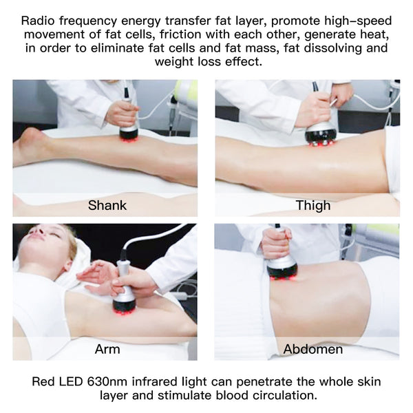 Máy cavitation 40K SQ47B Pro 6 trong 1 với RF đa cực, chân không, EMS & laser