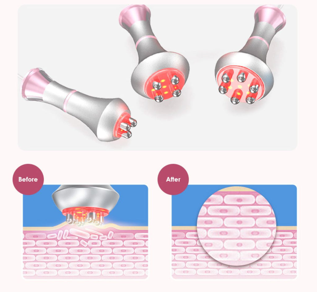 Máy cavitation 80K SQ121B Pro 6 trong 1 với RF, tấm laser/EMS vi dòng & massage chân không
