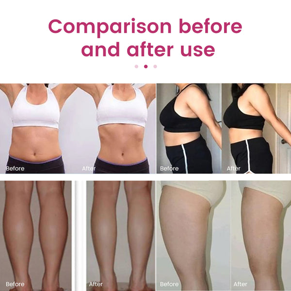 Máy làm đẹp cavitation 40K & RF SQ41 7 trong 1